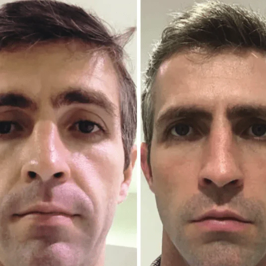 Resultado real cliente 1